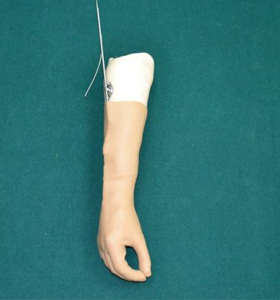 below elbow